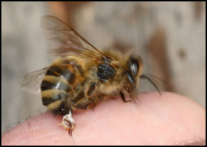 Sting of a honey bee.